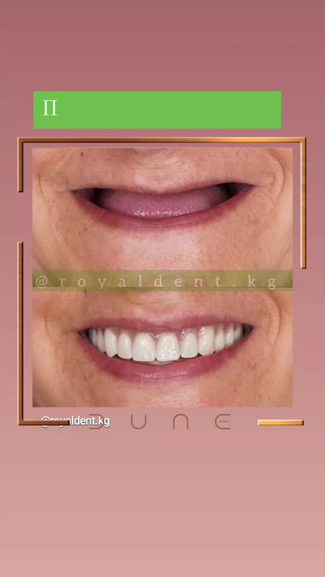 Ортопедия протезирование